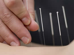 Anxiety: Acupuncture for anxiety